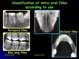 Classification of intra-oral films
                   according to use




    Periapical films
                                         Occlusal films




    Bite wing films
01/25/13 00:59         Ossama El-Shall
 