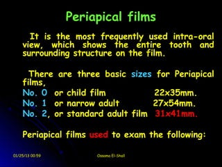 Periapical films
      It is the most frequently used intra-oral
    view, which shows the entire tooth and
    surrounding structure on the film.

      There are three basic sizes for Periapical
    films,
    No. 0 or child film           22x35mm.
    No. 1 or narrow adult         27x54mm.
    No. 2, or standard adult film 31x41mm.

    Periapical films used to exam the following:

01/25/13 00:59        Ossama El-Shall
 