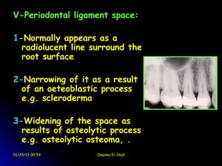 V-Periodontal ligament space:

1-Normally appears as a
  radiolucent line surround the
  root surface

2-Narrowing of it as a result
  of an oeteoblastic process
  e.g. scleroderma

3-Widening of the space as
  results of osteolytic process
  e.g. osteolytic osteoma, .
01/25/13 00:59      Ossama El-Shall
 