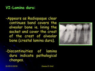 VI-Lamina dura:

-Appears as Radiopaque clear
  continues band covers the
  alveolar bone ie. lining the
  socket and cover the crest
  of the crest of alveolar
  bone (crestal lamina dura).

-Discontinuities of lamina
  dura indicate pathological
  changes.
01/25/13 00:59       Ossama El-Shall
 