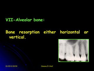 VII-Alveolar bone:

Bone resorption      either horizontal   or
 vertical.




01/25/13 00:59    Ossama El-Shall
 