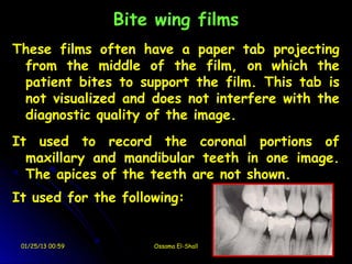 Bite wing films
These films often have a paper tab projecting
 from the middle of the film, on which the
 patient bites to support the film. This tab is
 not visualized and does not interfere with the
 diagnostic quality of the image.
It used to record the coronal portions of
  maxillary and mandibular teeth in one image.
  The apices of the teeth are not shown.
It used for the following:


 01/25/13 00:59       Ossama El-Shall
 