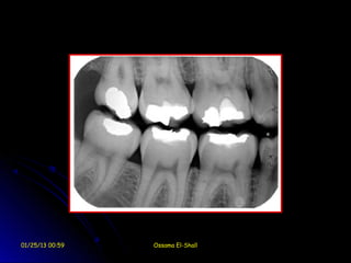 01/25/13 00:59   Ossama El-Shall
 
