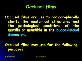Occlusal films

Occlusal films are use to radiographically
 clarify the anatomical structures and
 the pathological conditions of the
 maxilla or mandible in the bucco-lingual
 dimension.

Occlusal films may use for the following
 purposes:
01/25/13 00:59       Ossama El-Shall
 