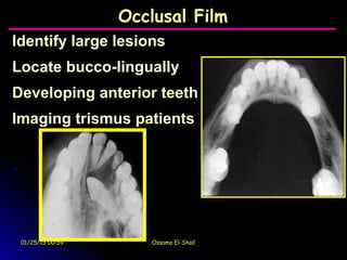 Occlusal Film
Identify large lesions
Locate bucco-lingually
Developing anterior teeth
Imaging trismus patients




 01/25/13 00:59      Ossama El-Shall
 