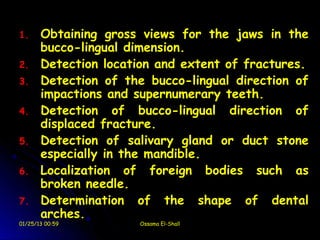 1.     Obtaining gross views for the jaws in the
       bucco-lingual dimension.
2.     Detection location and extent of fractures.
3.     Detection of the bucco-lingual direction of
       impactions and supernumerary teeth.
4.     Detection of bucco-lingual direction of
       displaced fracture.
5.     Detection of salivary gland or duct stone
       especially in the mandible.
6.     Localization of foreign bodies such as
       broken needle.
7.     Determination of the shape of dental
       arches.
01/25/13 00:59        Ossama El-Shall
 