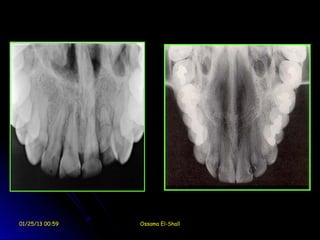 01/25/13 00:59   Ossama El-Shall
 