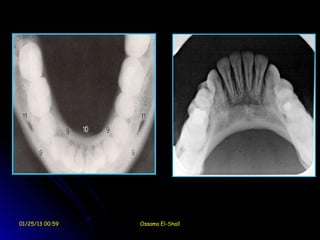 01/25/13 00:59   Ossama El-Shall
 