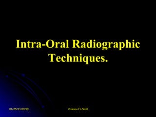 Intra-Oral Radiographic
          Techniques.



01/25/13 00:59   Ossama El-Shall
 