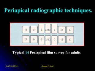 Periapical radiographic techniques.




        Typical 14 Periapical film survey for adults


01/25/13 00:59            Ossama El-Shall
 