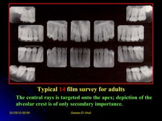 Typical 14 film survey for adults
    The central rays is targeted onto the apex; depiction of the
    alveolar crest is of only secondary importance.
01/25/13 00:59               Ossama El-Shall
 