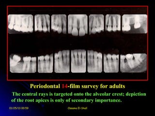 Periodontal 14-film survey for adults
 The central rays is targeted onto the alveolar crest; depiction
 of the root apices is only of secondary importance.
01/25/13 00:59                 Ossama El-Shall
 