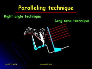Paralleling technique
Right angle technique
                                           Long cone technique




01/25/13 00:59           Ossama El-Shall
 