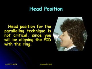 Head Position


  Head position for the
paralleling technique is
not critical, since you
will be aligning the PID
with the ring.



01/25/13 00:59       Ossama El-Shall
 