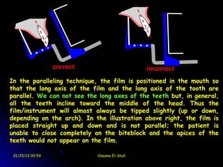 correct                     incorrect
In the paralleling technique, the film is positioned in the mouth so
that the long axis of the film and the long axis of the tooth are
parallel. We can not see the long axes of the teeth but, in general,
all the teeth incline toward the middle of the head. Thus the
film/instrument will almost always be tipped slightly (up or down,
depending on the arch). In the illustration above right, the film is
placed straight up and down and is not parallel; the patient is
unable to close completely on the biteblock and the apices of the
teeth would not appear on the film.

 01/25/13 00:59             Ossama El-Shall
 