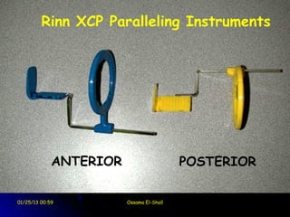 Rinn XCP Paralleling Instruments




             ANTERIOR                     POSTERIOR

01/25/13 00:59          Ossama El-Shall
 