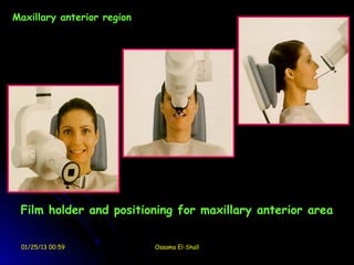 Maxillary anterior region




 Film holder and positioning for maxillary anterior area


 01/25/13 00:59             Ossama El-Shall
 