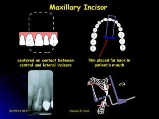 Maxillary Incisor




     centered on contact between             film placed far back in
      central and lateral incisors               patient’s mouth




01/25/13 00:59                 Ossama El-Shall
 