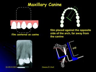 Maxillary Canine




                                          film placed against the opposite
      film centered on canine             side of the arch, far away from
                                          the canine




01/25/13 00:59                  Ossama El-Shall
 