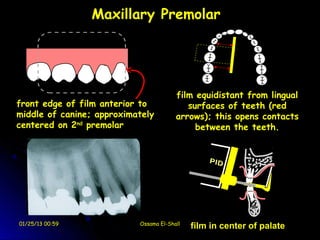 Maxillary Premolar




                                        film equidistant from lingual
front edge of film anterior to             surfaces of teeth (red
middle of canine; approximately         arrows); this opens contacts
centered on 2nd premolar                     between the teeth.




01/25/13 00:59             Ossama El-Shall
                                             film in center of palate
 