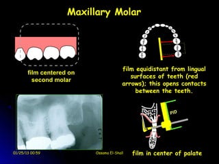 Maxillary Molar




                                        film equidistant from lingual
       film centered on
                                           surfaces of teeth (red
         second molar
                                        arrows); this opens contacts
                                             between the teeth.




01/25/13 00:59            Ossama El-Shall   film in center of palate
 
