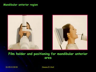 Mandibular anterior region




    Film holder and positioning for mandibular anterior
                            area

 01/25/13 00:59              Ossama El-Shall
 