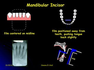 Mandibular Incisor




                                         film positioned away from
film centered on midline                    teeth, pushing tongue
                                                back slightly




 01/25/13 00:59            Ossama El-Shall
 