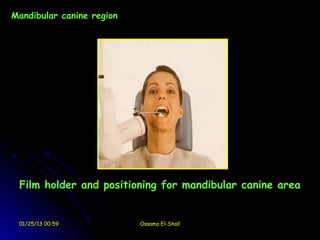 Mandibular canine region




 Film holder and positioning for mandibular canine area


 01/25/13 00:59            Ossama El-Shall
 