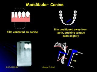 Mandibular Canine




                                         film positioned away from
 film centered on canine                    teeth, pushing tongue
                                                 back slightly




01/25/13 00:59             Ossama El-Shall
 