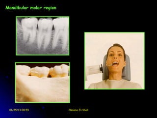 Mandibular molar region




 01/25/13 00:59           Ossama El-Shall
 