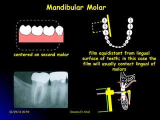 Mandibular Molar




  centered on second molar               film equidistant from lingual
                                      surface of teeth; in this case the
                                      film will usually contact lingual of
                                                     molars




01/25/13 00:59               Ossama El-Shall
 