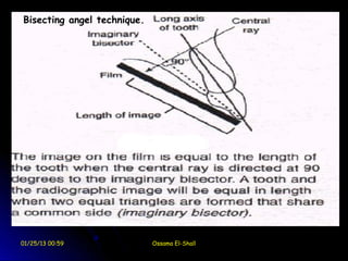 Bisecting angel technique.




01/25/13 00:59               Ossama El-Shall
 