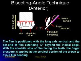 The film is positioned with the long axis vertical and the
dot-end of film extending ¼” beyond the incisal edge.
With the all-white side of film facing the teeth, the finger
pressure is applied at the cervical portion of the crown to
avoid film bending.
 01/25/13 00:59          Ossama El-Shall
 