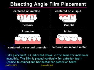 Film placement, as indicated above, is the same for maxilla or
 mandible. The film is placed vertically for anterior teeth
 (canine to canine) and horizontal for posterior teeth.
01/25/13 00:59             Ossama El-Shall
 