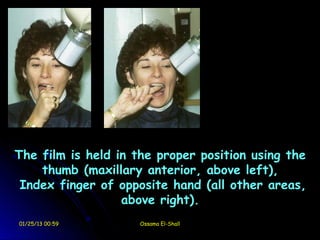 The film is held in the proper position using the
    thumb (maxillary anterior, above left),
 Index finger of opposite hand (all other areas,
                  above right).
01/25/13 00:59       Ossama El-Shall
 