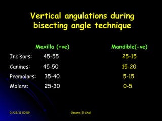 Vertical angulations during
                  bisecting angle technique

                  Maxilla (+ve)                     Mandible(-ve)
Incisors:           45-55                              25-15
Canines:            45-50                              15-20
Premolars:           35-40                              5-15
Molars:              25-30                              0-5



01/25/13 00:59                    Ossama El-Shall
 