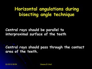 Horizontal angulations during
            bisecting angle technique


Central rays should be parallel to
interproximal surface of the teeth


Central rays should pass through the contact
area of the teeth.


01/25/13 00:59        Ossama El-Shall
 
