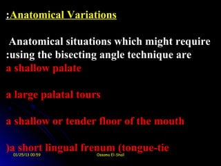:Anatomical Variations

 Anatomical situations which might require
:using the bisecting angle technique are
a shallow palate

a large palatal tours

a shallow or tender floor of the mouth

(a short lingual frenum (tongue-tie
 01/25/13 00:59     Ossama El-Shall
 