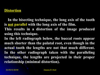 Distortion

   In the bisecting technique, the long axis of the tooth
is not parallel with the long axis of the film.
This results in a distortion of the image produced
using this technique.
In the left radiograph below, the buccal roots appear
much shorter than the palatal root, even though in the
actual tooth the lengths are not that much different.
In the other radiograph taken with the paralleling
technique, the lengths are projected in their proper
relationship (minimal distortion(.
 01/25/13 00:59         Ossama El-Shall
 