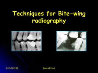 Techniques for Bite-wing
             radiography




01/25/13 00:59   Ossama El-Shall
 
