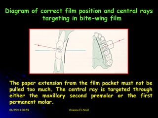 Diagram of correct film position and central rays
            targeting in bite-wing film




 The paper extension from the film packet must not be
 pulled too much. The central ray is targeted through
 either the maxillary second premolar or the first
 permanent molar.
 01/25/13 00:59       Ossama El-Shall
 
