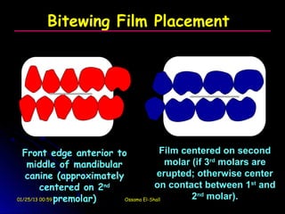 Bitewing Film Placement




  Front edge anterior to                  Film centered on second
    middle of mandibular                    molar (if 3rd molars are
   canine (approximately                 erupted; otherwise center
         centered on 2   nd             on contact between 1st and
01/25/13 00:59 premolar)    Ossama El-Shall       2nd molar).
 