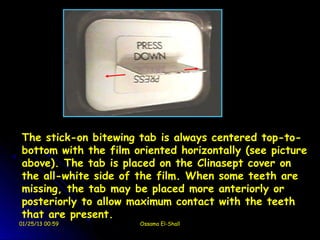 The stick-on bitewing tab is always centered top-to-
bottom with the film oriented horizontally (see picture
above). The tab is placed on the Clinasept cover on
the all-white side of the film. When some teeth are
missing, the tab may be placed more anteriorly or
posteriorly to allow maximum contact with the teeth
that are present.
01/25/13 00:59        Ossama El-Shall
 
