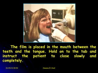 The film is placed in the mouth between the
teeth and the tongue. Hold on to the tab and
instruct the patient to close slowly and
completely.
 01/25/13 00:59     Ossama El-Shall
 