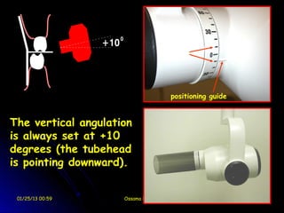 10°

                                       positioning guide


The vertical angulation
is always set at +10
degrees (the tubehead
is pointing downward).


 01/25/13 00:59      Ossama El-Shall
 