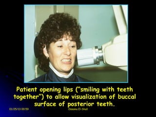 Patient opening lips (“smiling with teeth
   together”) to allow visualization of buccal
          surface of posterior teeth.
01/25/13 00:59        Ossama El-Shall
 
