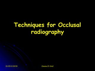 Techniques for Occlusal
              radiography




01/25/13 00:59    Ossama El-Shall
 