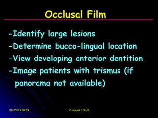 Occlusal Film
-Identify large lesions
-Determine bucco-lingual location
-View developing anterior dentition
-Image patients with trismus (if
   panorama not available)


01/25/13 00:59        Ossama El-Shall
 