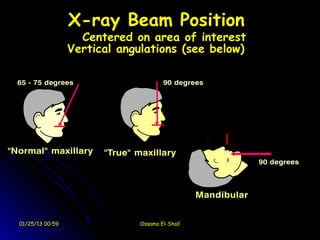 X-ray Beam Position
                   Centered on area of interest
                 Vertical angulations (see below)




01/25/13 00:59                Ossama El-Shall
 