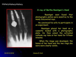 History History History


                                X-ray of Bertha Roentgen's Hand

                                       Roentgen soon found that
                             photographic plates were sensitive to the
                             newly discovered rays.
                                He convinced his wife to participate in
                             an experiment.
                                   Roentgen placed her hand on a
                             cassette loaded with a photographic
                             plate. He then aimed the activated
                             cathode ray tube at her hand for fifteen
                             minutes.
                                 When the image was developed, the
                             bones of her hand and the two rings she
                             wore were clearly visible.


  01/25/13 00:59          Ossama El-Shall
 